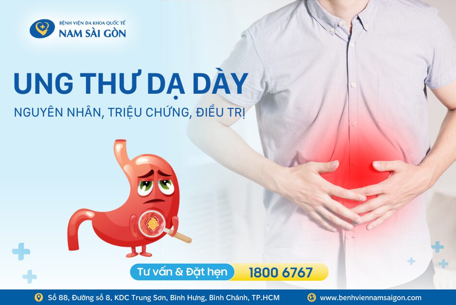 STOMACH CANCER – SYMPTOMS, CAUSES, TREATMENT