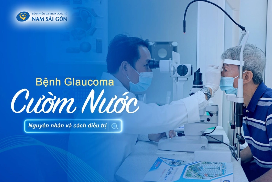 BỆNH CƯỜM NƯỚC (GLAUCOMA) – NGUYÊN NHÂN, TRIỆU CHỨNG VÀ ĐIỀU TRỊ