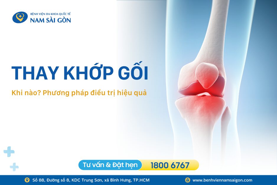 phuong-phap-thay-khop-goi