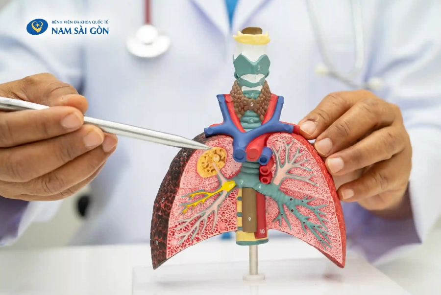 VIÊM PHẾ QUẢN – NGUYÊN NHÂN, DẤU HIỆU, ĐỐI TƯỢNG VÀ CÁCH PHÒNG NGỪA