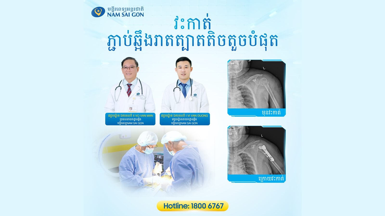 កម្មវិធីនៃការវះកាត់ឆ្អឹងដែលរាតត្បាតតិចតួចក្នុងការព្យាបាលការបាក់បែកឆ្អឹងកនឹងដៃ