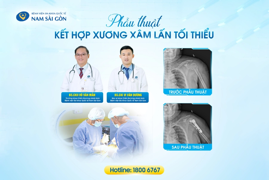 PHẪU THUẬT KẾT HỢP XƯƠNG XÂM LẤN TỐI THIỂU – ĐIỀU TRỊ GÃY CỔ PHẪU THUẬT XƯƠNG CÁNH TAY