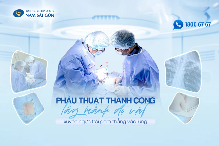 THÀNH CÔNG LẤY MẢNH DỊ VẬT XUYÊN NGỰC TRÁI GĂM THẲNG VÀO LƯNG