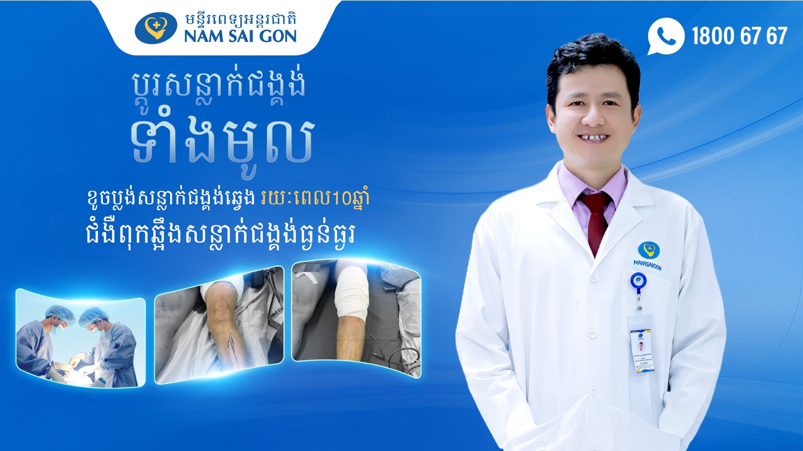 ប្តូរជង្គង់ទាំងមូលដើម្បីកែបញ្ហាផ្លាស់ទីជង្គង់បន្ទាប់ពី 10 ឆ្នាំនៃការពុកជង្គង់ធ្ងន់ធ្ងរ