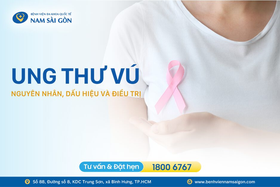 UNG THƯ VÚ – DẤU HIỆU, NGUYÊN NHÂN, CHUẨN ĐOÁN VÀ CÁCH ĐIỀU TRỊ