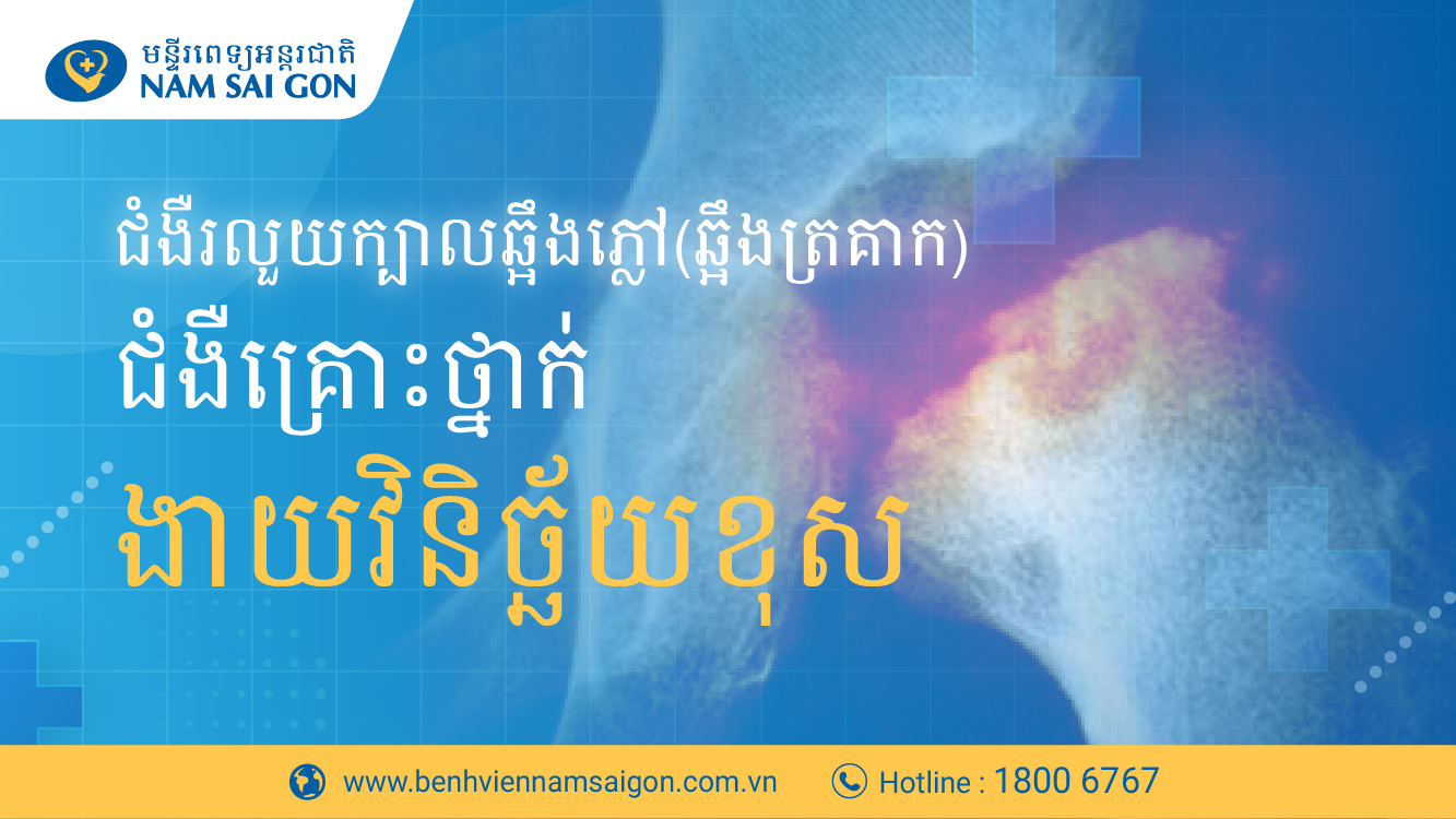 រលួយក្បាលឆ្អឹងភ្លៅ(ឆ្អឹងក្បាលត្រគាក)  – ជំងឺគ្រោះថ្នាក់ងាយរោគវិនិច្ឆ័យខុស