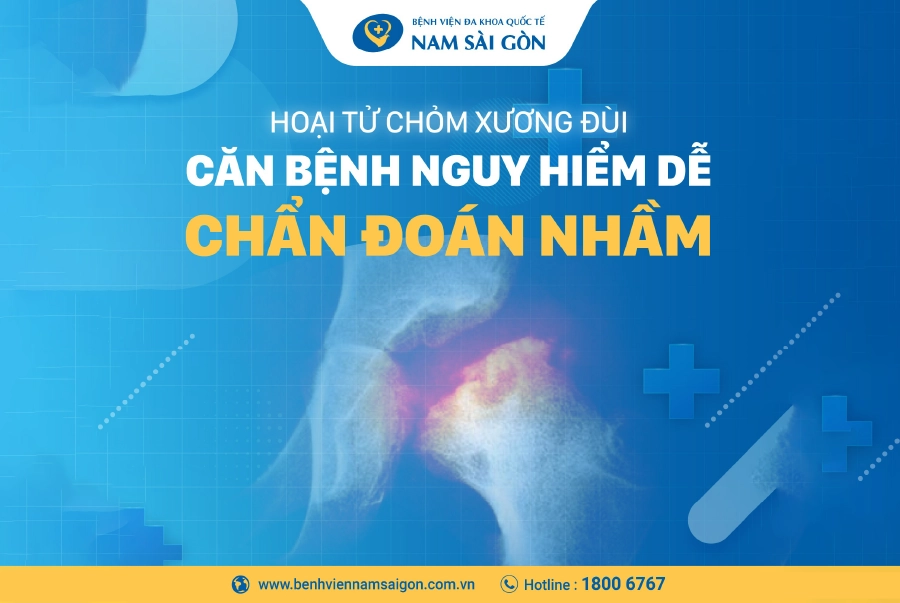 HOẠI TỬ CHỎM XƯƠNG ĐÙI – CĂN BỆNH NGUY HIỂM DỄ CHẨN ĐOÁN NHẦM