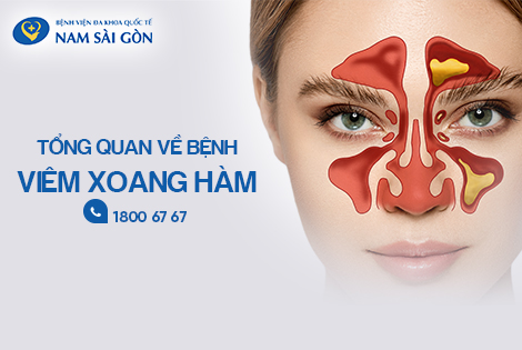 VIÊM XOANG HÀM: NGUYÊN NHÂN, CHUẨN ĐOÁN, ĐIỀU TRỊ