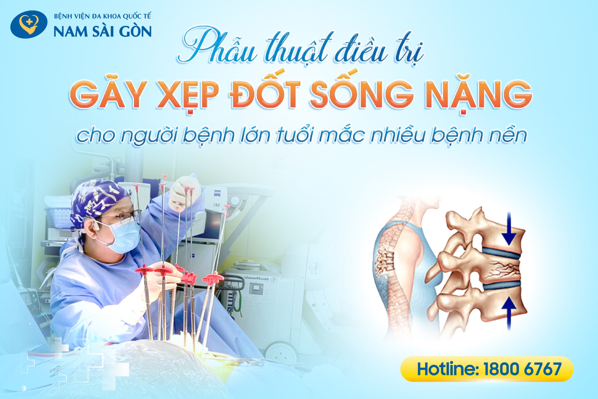 dieu tri gay xep dot song 01 1 7