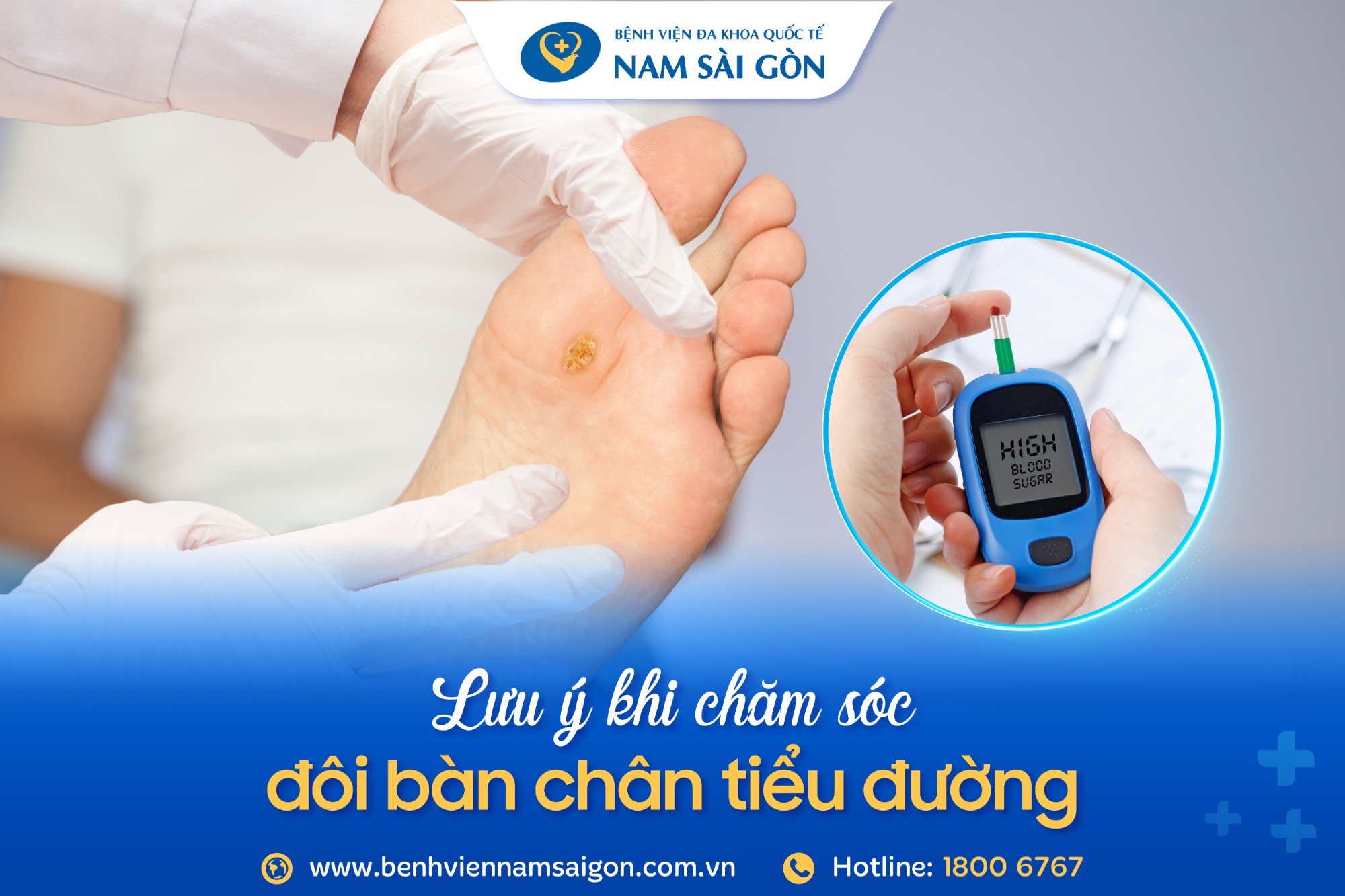 CÁCH CHĂM SÓC BÀN CHÂN TIỂU ĐƯỜNG VÀ 10 ĐIỀU CẦN LƯU Ý