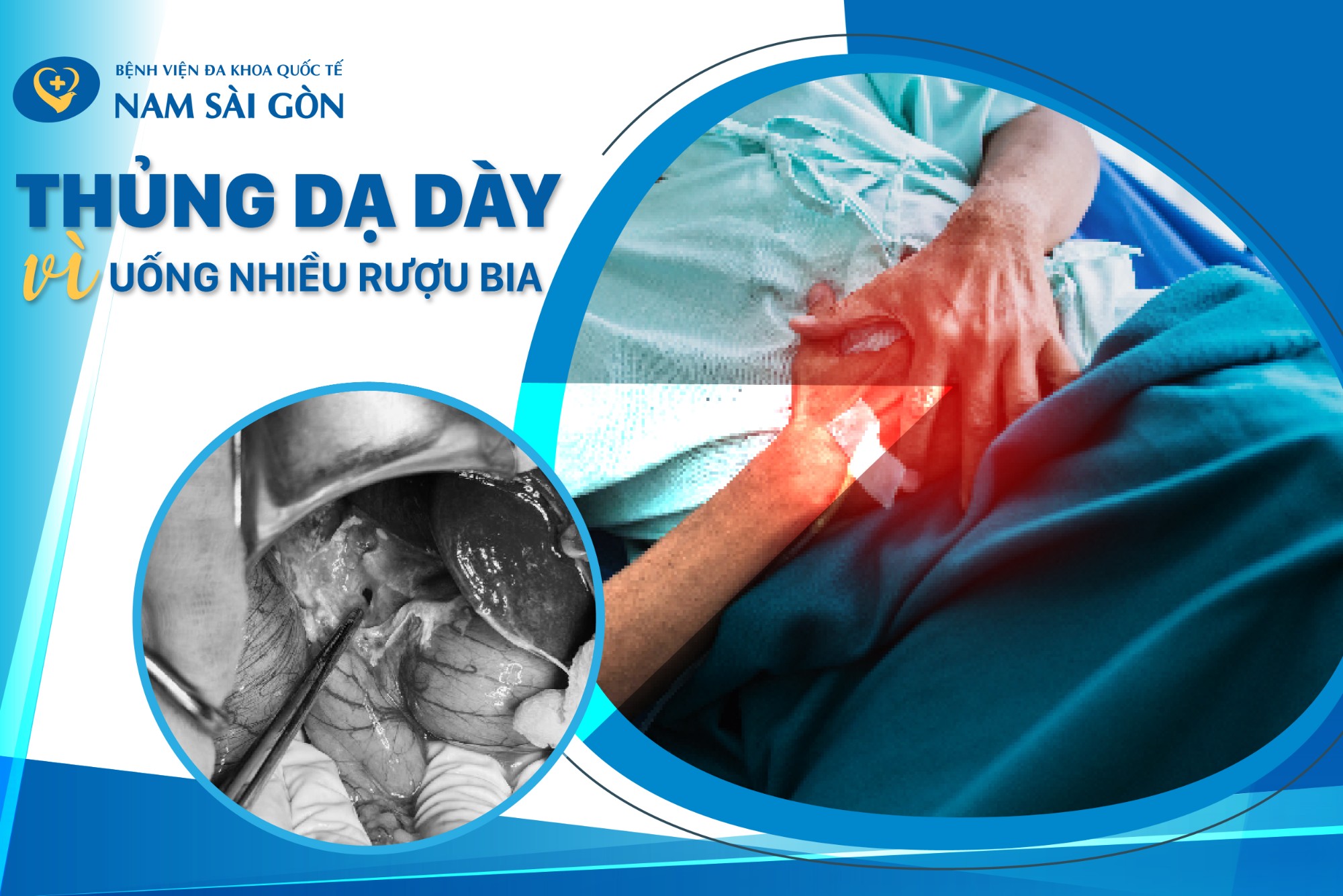 nth thiet ke ca benh thung da day do uong nhieu bia ruou 01 1 3