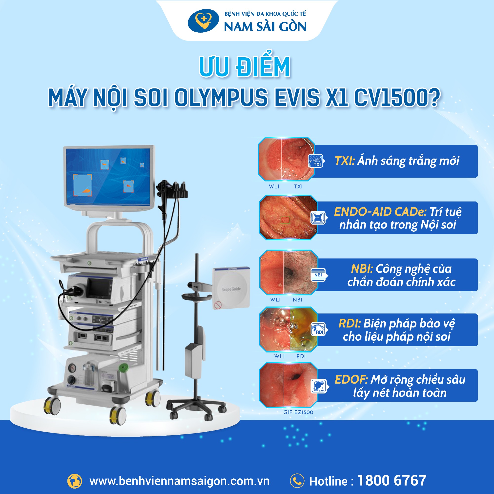 HỆ THỐNG NỘI SOI OLYMPUS EVIS X1 CV1500