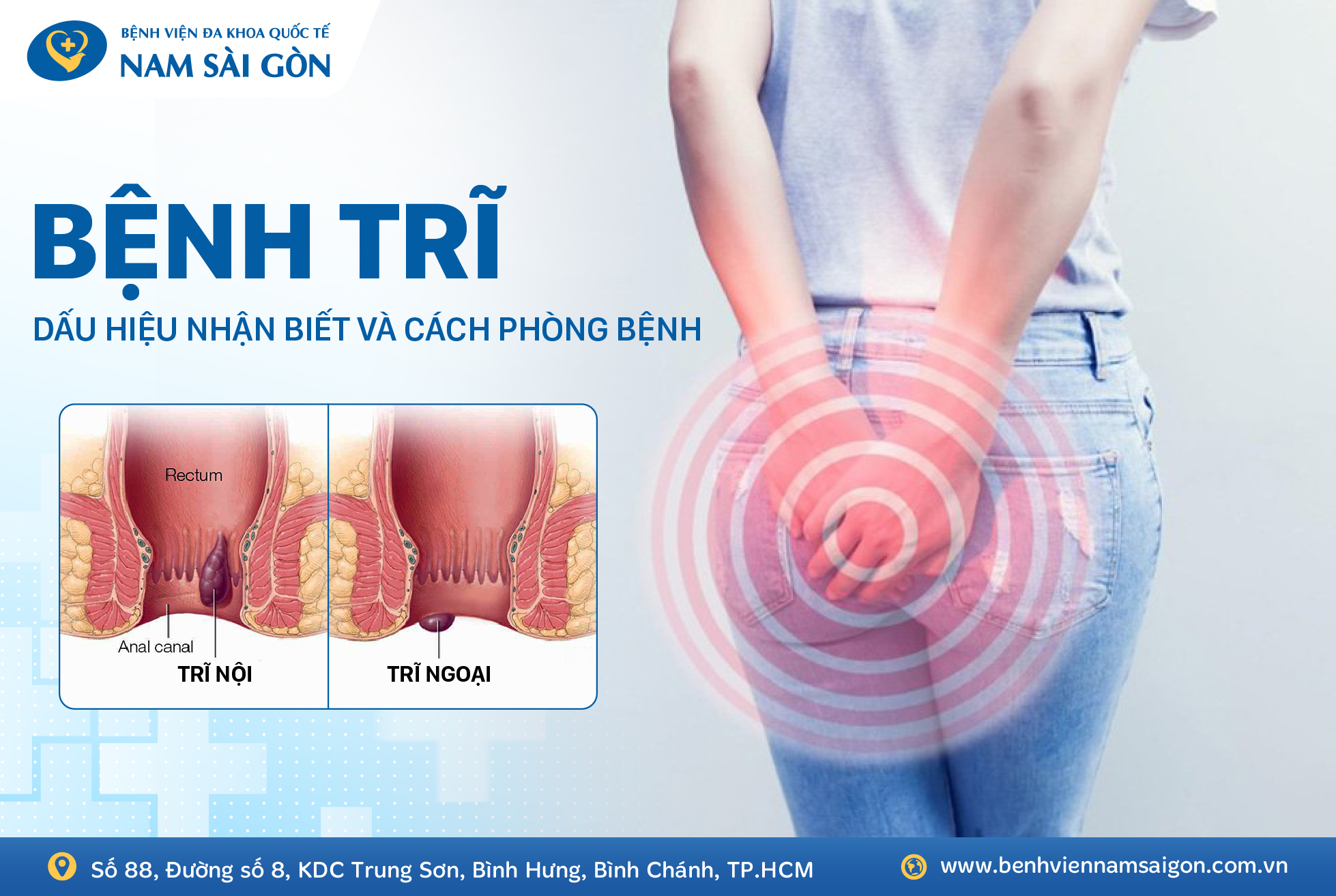 HEMORRHOIDS – SYMPTOMS, CAUSES & TREATMENT