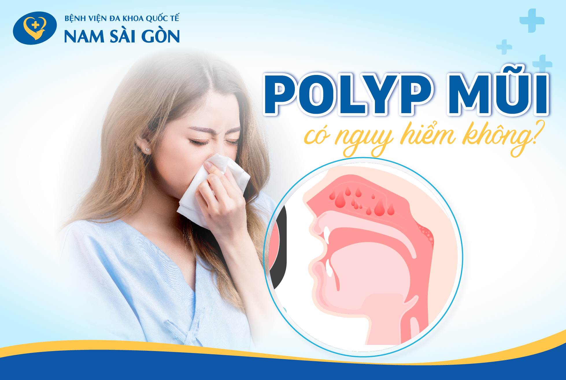 POLYP MŨI – NGUYÊN NHÂN, TRIỆU CHỨNG VÀ CÁCH ĐIỀU TRỊ