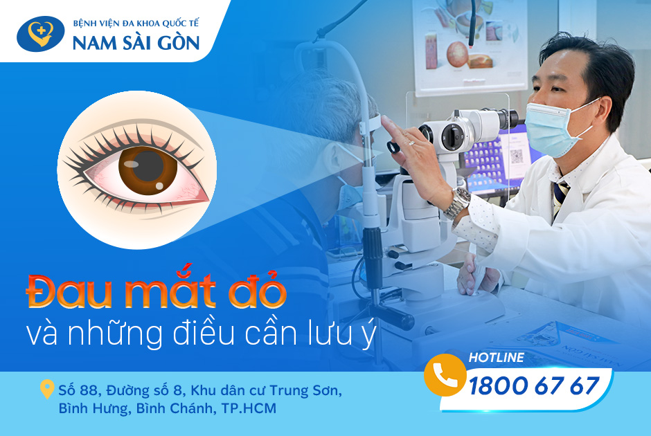 PINK EYE – SYMPTOMS, CAUSES AND TREATMENT