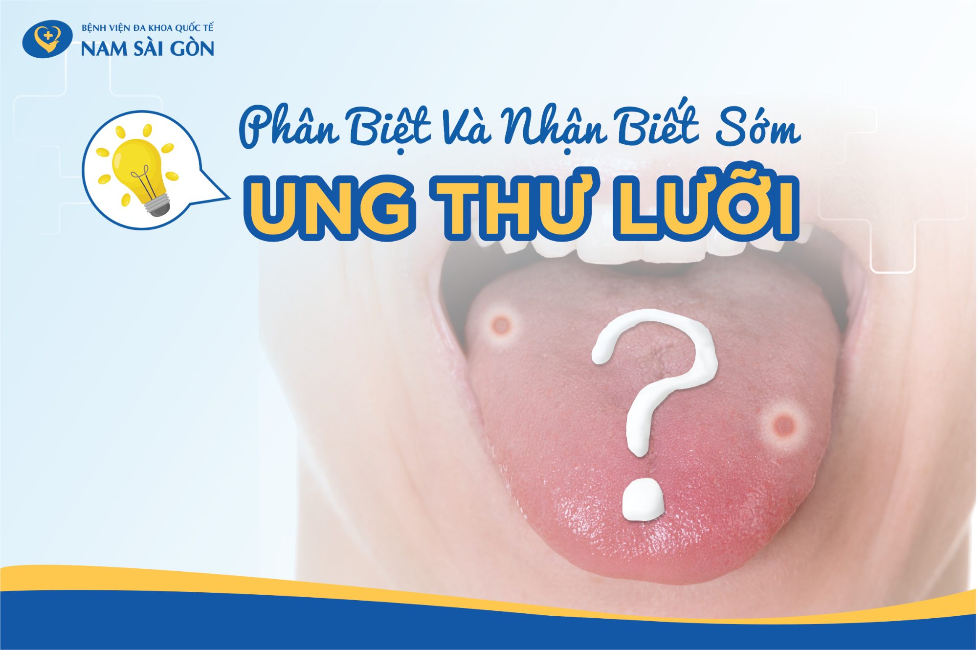 DISTINGUISH AND EARLY RECOGNIZE TONGUE CANCER