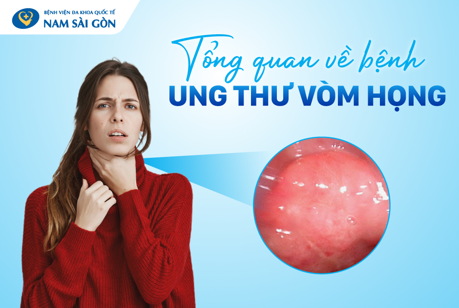 UNG THƯ VÒM HỌNG – NGUYÊN NHÂN, TRIỆU CHỨNG, ĐIỀU TRỊ