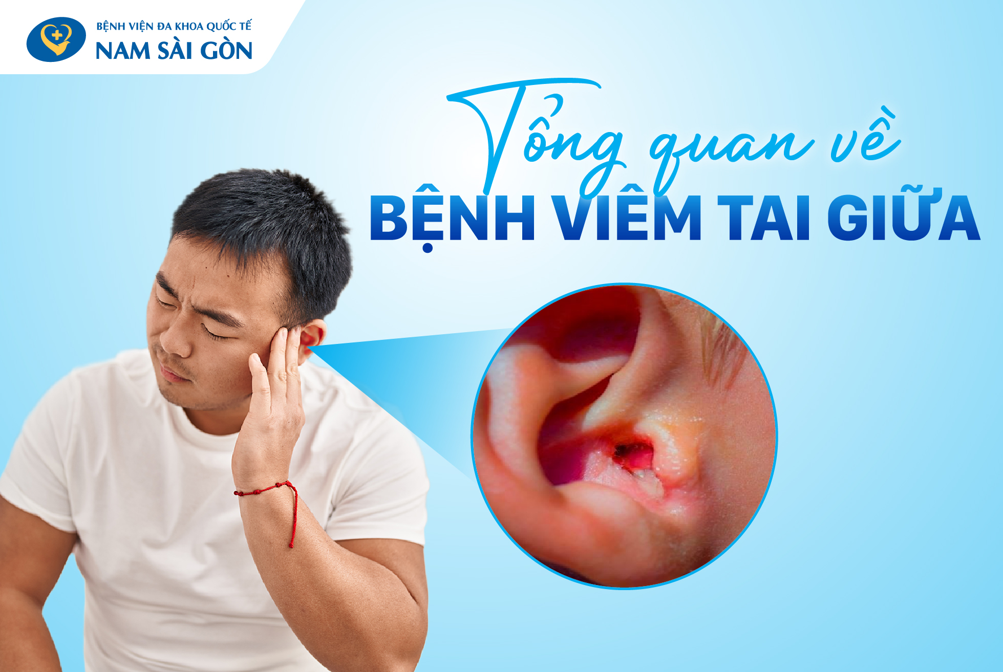 VIÊM TAI GIỮA – NGUYÊN NHÂN, DẤU HIỆU, CHẨN ĐOÁN, ĐIỀU TRỊ
