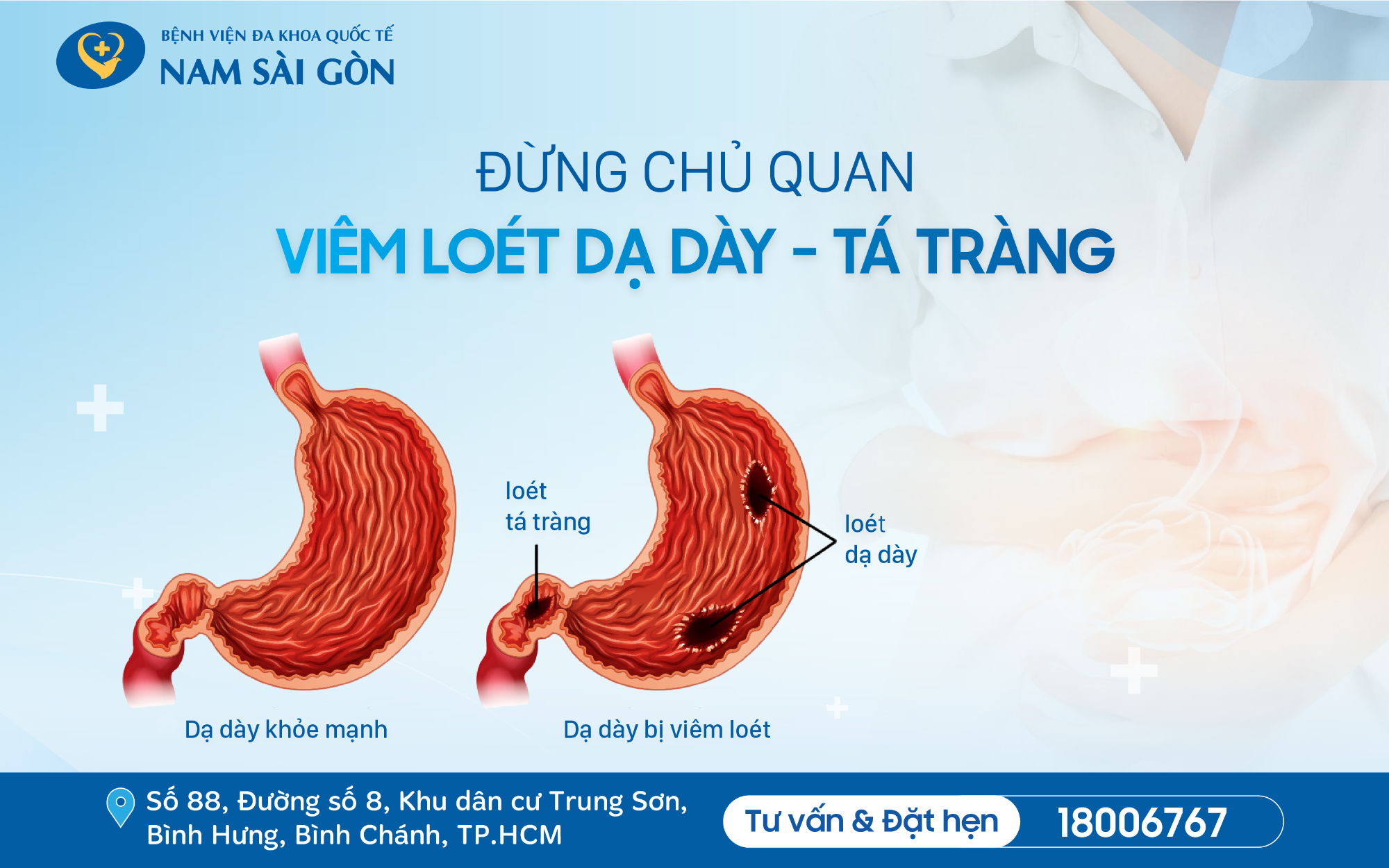 THỦNG DẠ DÀY DO VIÊM LOÉT DẠ DÀY LÂU NGÀY KHÔNG ĐIỀU TRỊ