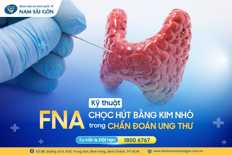 Thumbnail web FNA
