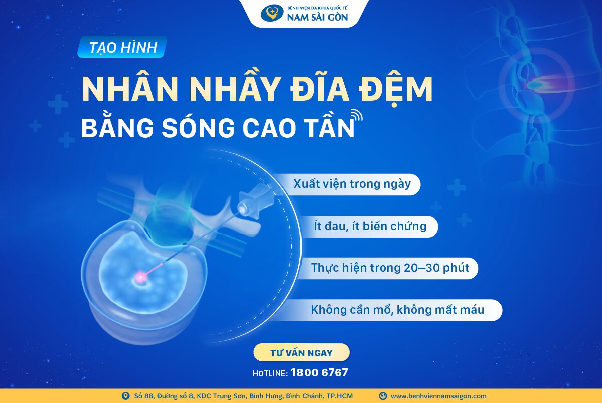 Thumbnail Website Tao hinh Nhan nhay dia dem bang song cao tan 2025