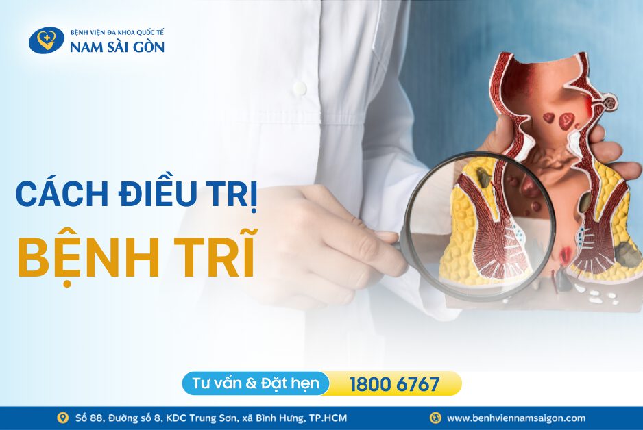 CÁCH ĐIỀU TRỊ BỆNH TRĨ HIỆU QUẢ VÀ PHỔ BIẾN HIỆN NAY