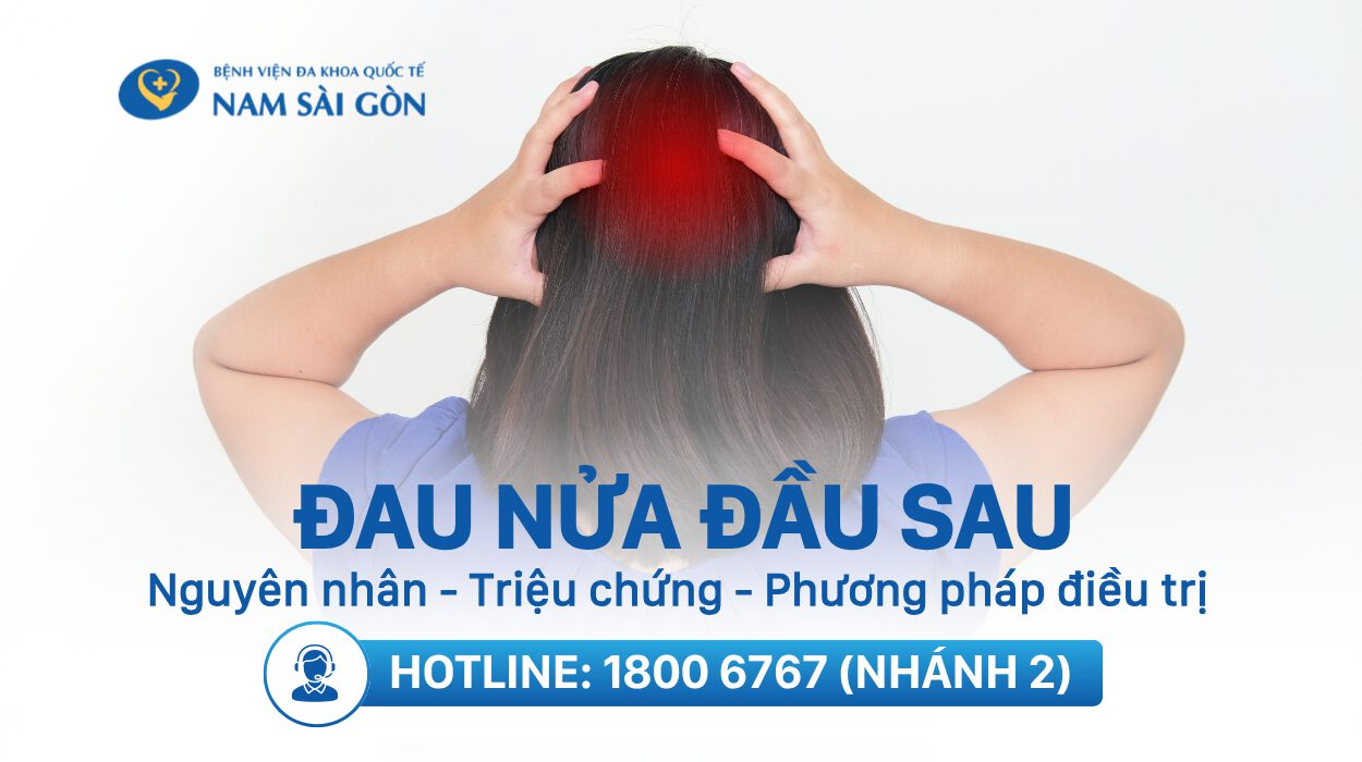 ĐAU NỬA ĐẦU SAU – NGUYÊN NHÂN, TRIỆU CHỨNG VÀ PHƯƠNG PHÁP ĐIỀU TRỊ